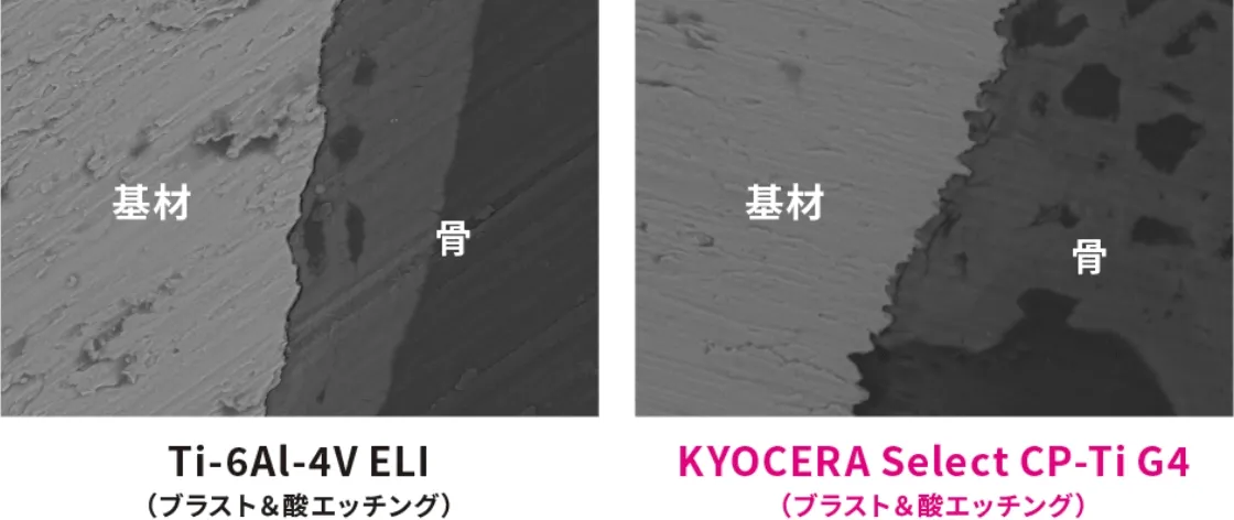 断面SEM写真