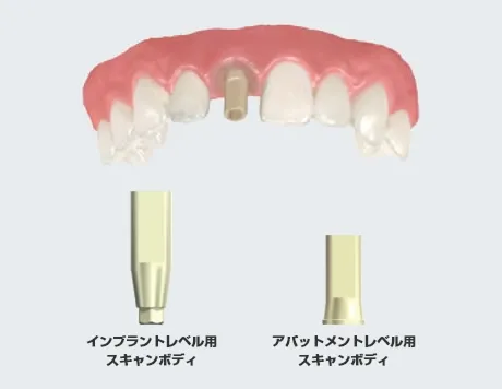 インプラントレベル用スキャンボディとアバットメントレベル用スキャンボディ