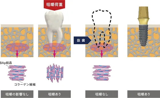 咀嚼状態に応じた生体アパタイト結晶とコラーゲン線維の配向変化の模式図