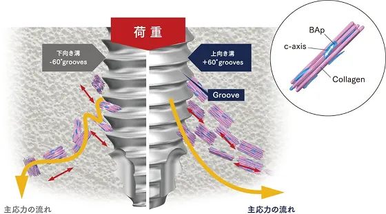 インプラント体の上向き溝・下向き溝周囲における配向性の概念図