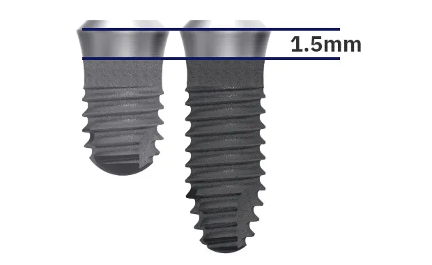 カラー高さ1.5mmの模式図