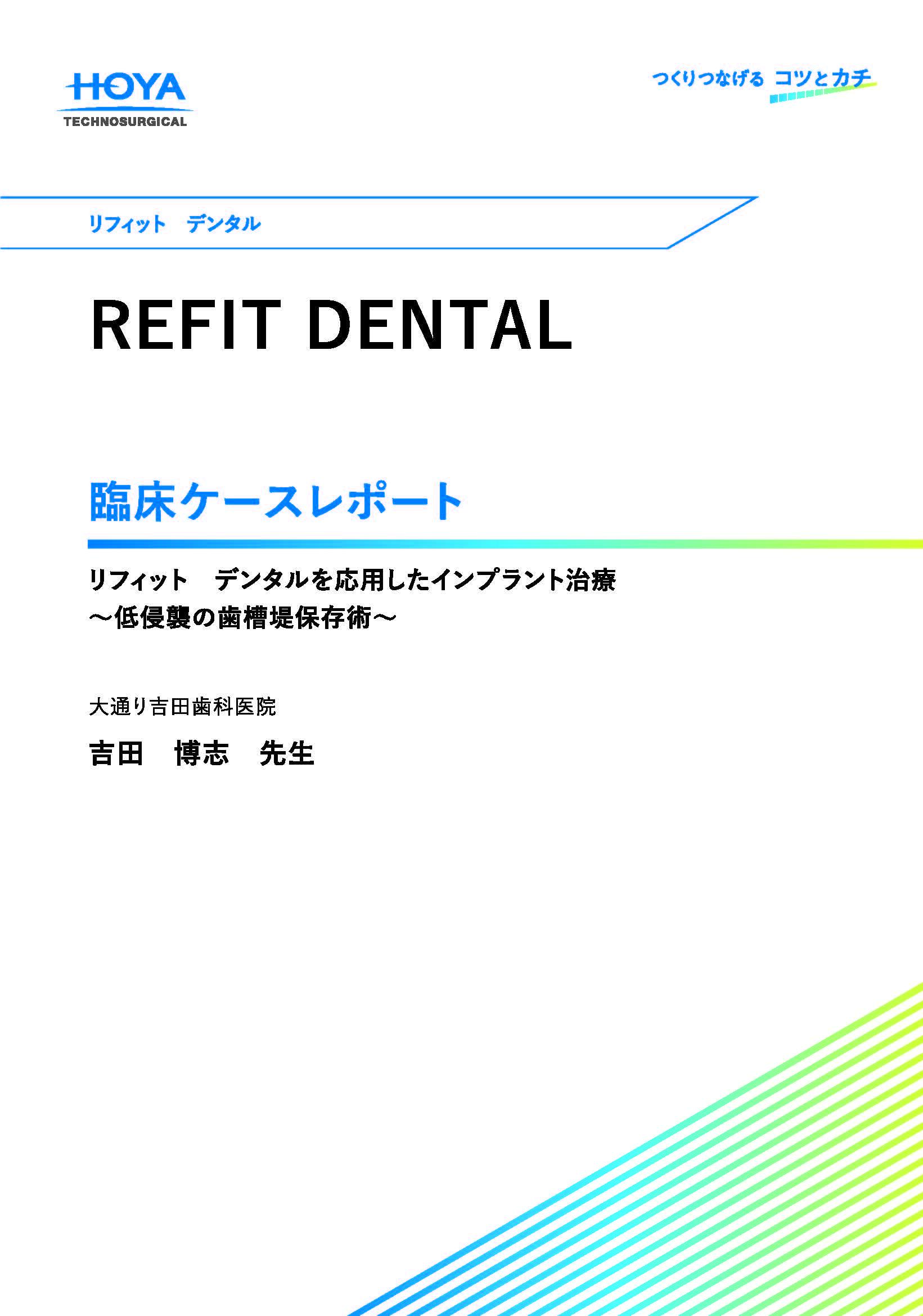 リフィット　デンタルを応用したインプラント治療～低侵襲の歯槽堤保存術～（2MB）